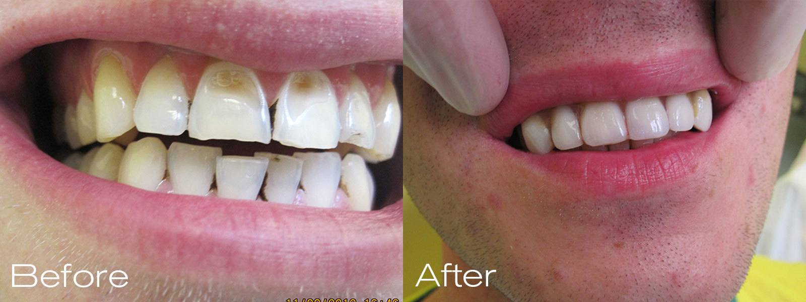 007 A & D Dental Practice & Laboratory Nottingham Emergency Appointments